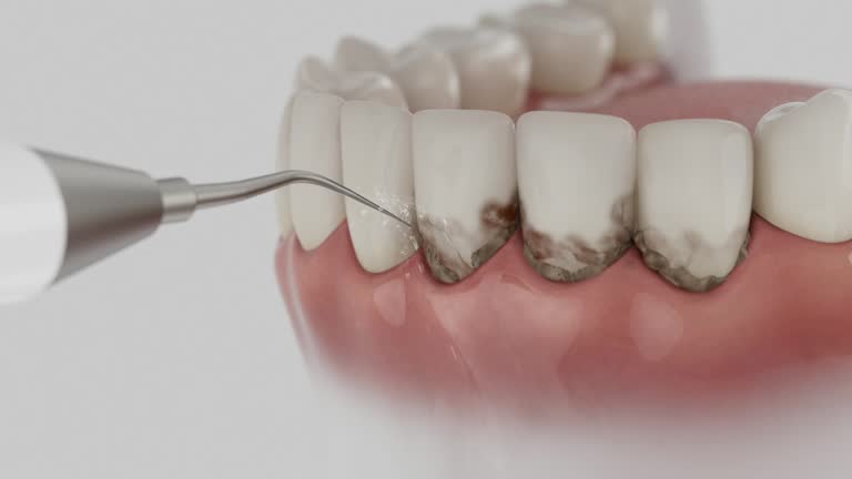 Reliable Teeth Cleaning And Checkup contractor in Mercer County County, OH by Dentist Open Now